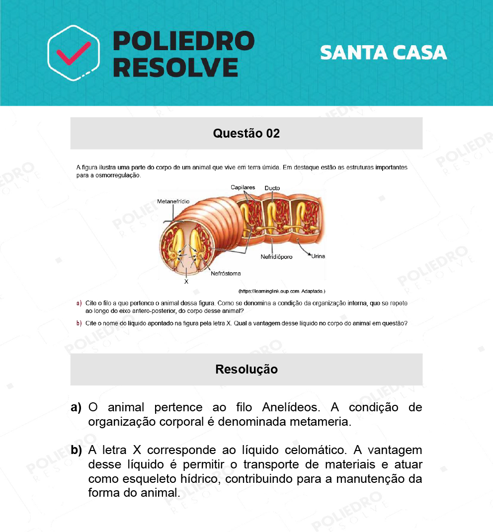 Dissertativa 2 - 2º Dia - Santa Casa 2022