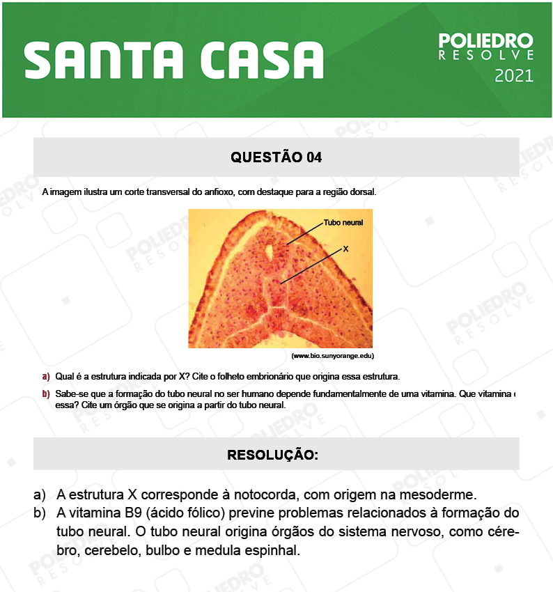 Dissertativa 4 - 2º Dia - Santa Casa 2021