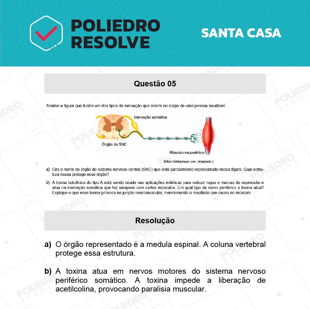 Dissertativa 5 - 2º Dia - Santa Casa 2022