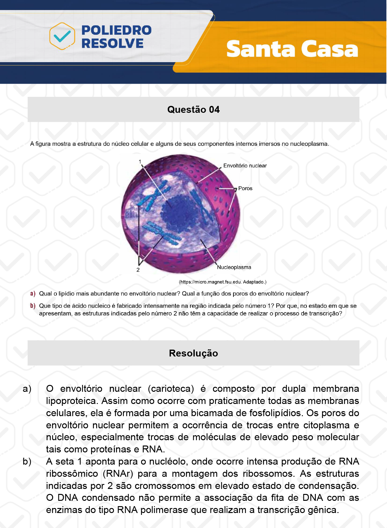 Dissertativa 4 - 2º Dia - Santa Casa 2024